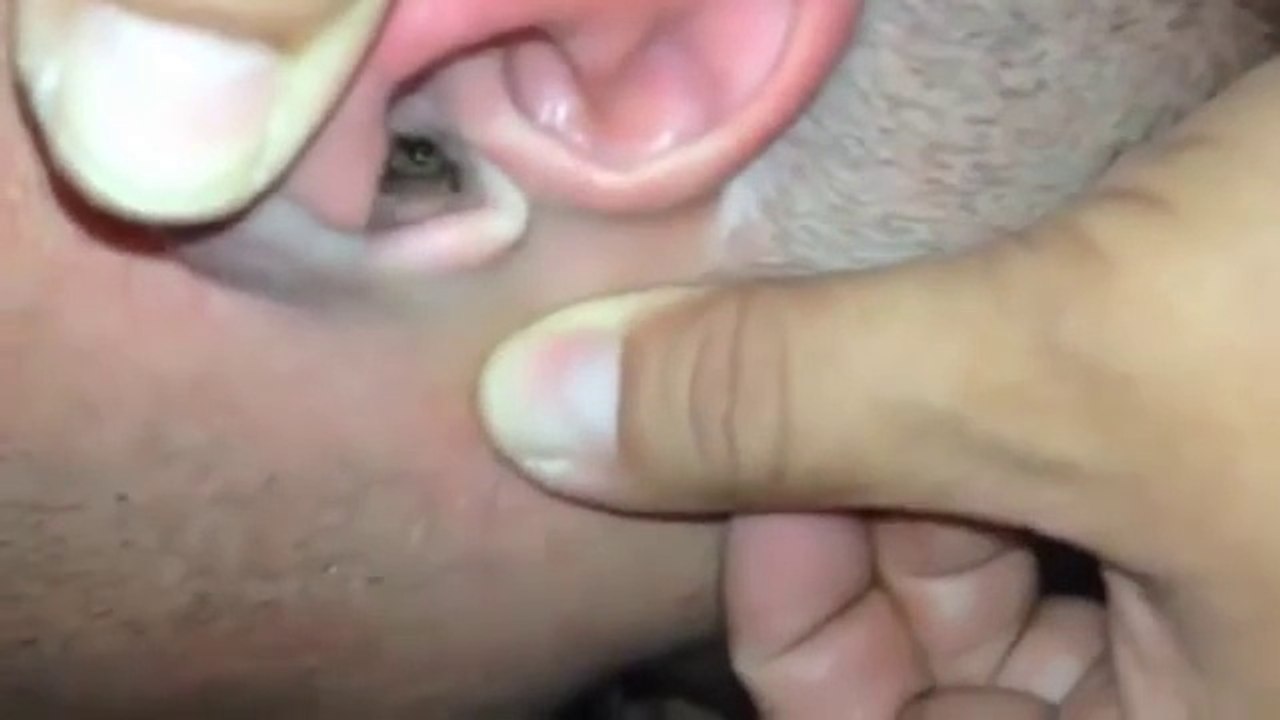 Algo le causaba dolor dentro del oido... Cuando lo veas quedaras en SHOCK