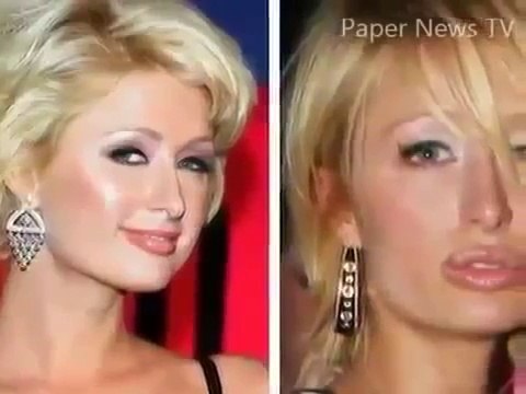 Plastic surgery gone wrong: Korean model disfigured after cooking oil injections