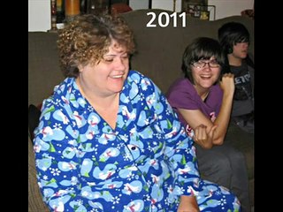 My LCHF Ketogenic Diet Weight Loss Before and After Pictures