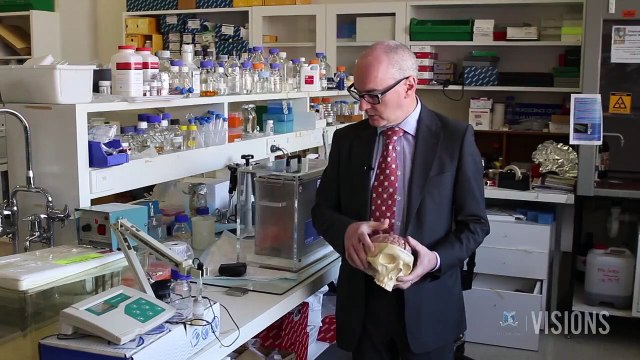 Visions: Device Predicts Epilepsy Seizures