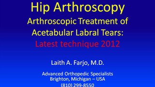 Hip arthroscopy - labral repair 2.0