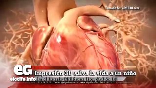 Impresión 3D salva el corazón de un niño #Veracruz @elgolfoveracruz #CienciaTecnología