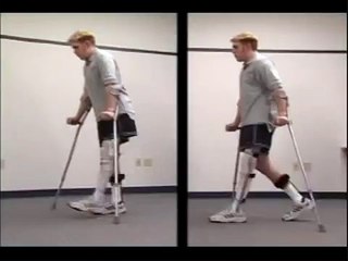 Stance Control KAFO vs. Locked Knee KAFO