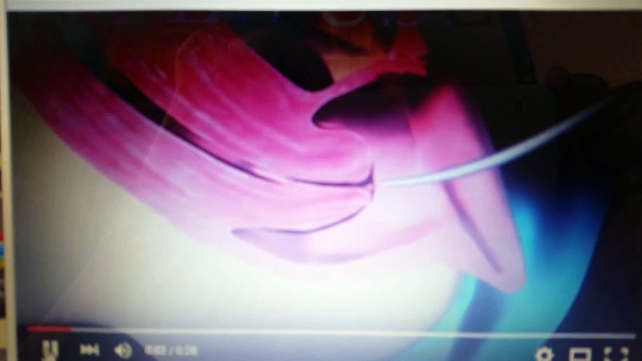 kürtaj Nasıl Yapılır ? Jinekolog Op. Dr. Turgay Karakaya