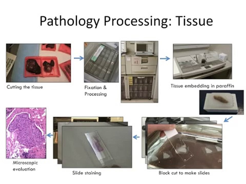 GRACEcast-127_CA-101_Intro to Molecular Pathology with Dr. Aisner, Part 1: What Do the Terms Mean?