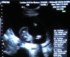 5th Month Vital Organs Ultrascan