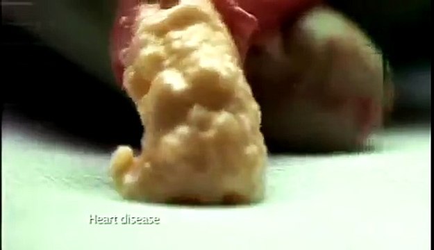 Everybody knows smoking kills