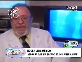 SALFATE - implantes extraterrestres