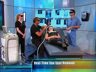 photofacial featured on the doctors show