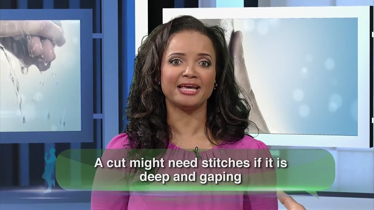 When Do You Need Stitches?