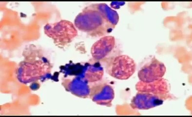 Dog Cancer Vaccine - Canine Maligant Melanoma