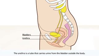 Bladder infection - Causes and treatmentbladder stone removalUrinary Tract Infec