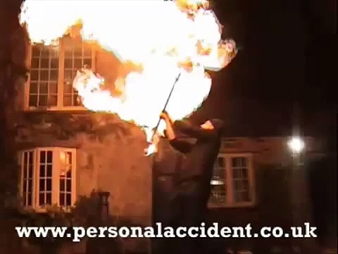 Kid fire dancing poi boy accident