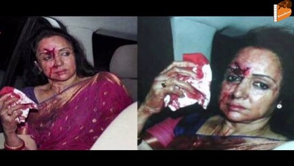 Exclusive Pics of Hema Malini after surgery | Bollywood News