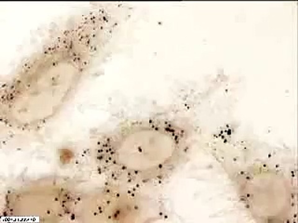 HeLa cells dividing over 27hrs cells round up grow hair then divide