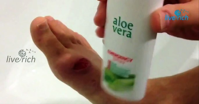 LR Aloe Vera Emergency Spray
