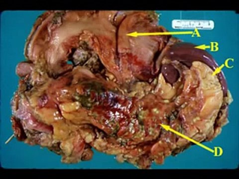 Hans Teeuwen Snelkookpan