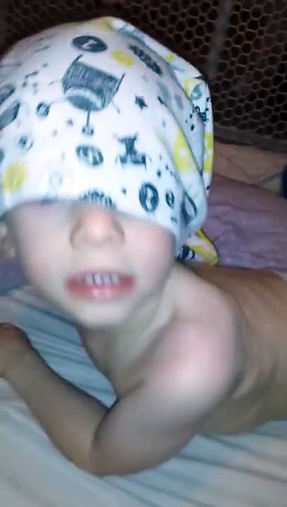 LP Is a Goofy Boy