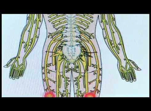 FIBROMYALGIA & CHRONIC FATIGUE DRUG FREE TREATMENT PAIN RELIEF NORTHERN NJ NEW JERSEY BERGEN County