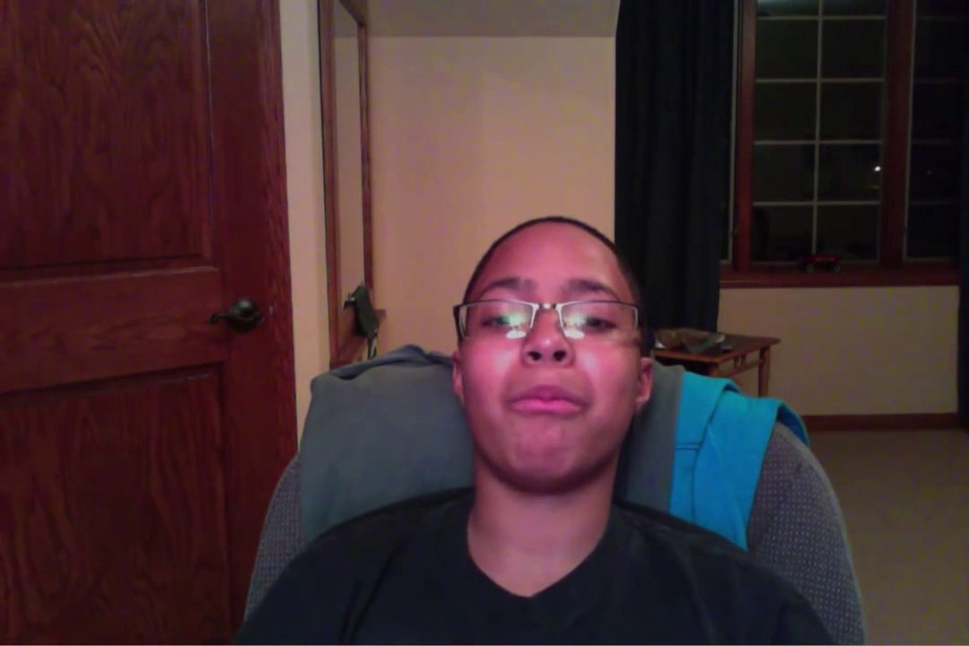 review on the herbst device and braces