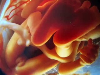 Las-imA?genes-de-fetos-y-embriones-que-han-dad