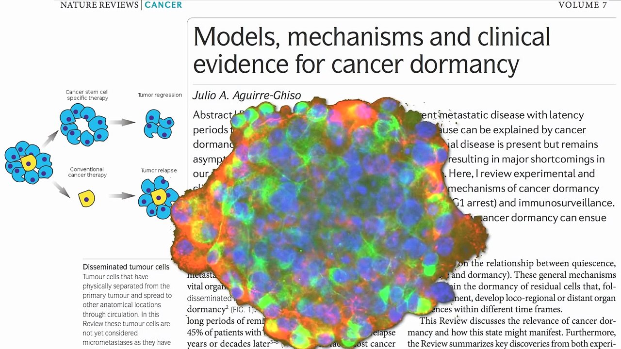 Broccoli Versus Breast Cancer Stem Cells