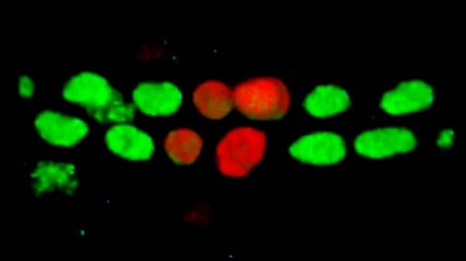 Karyokinesis defects during asymmetric cell division of cardiac progenitor cells
