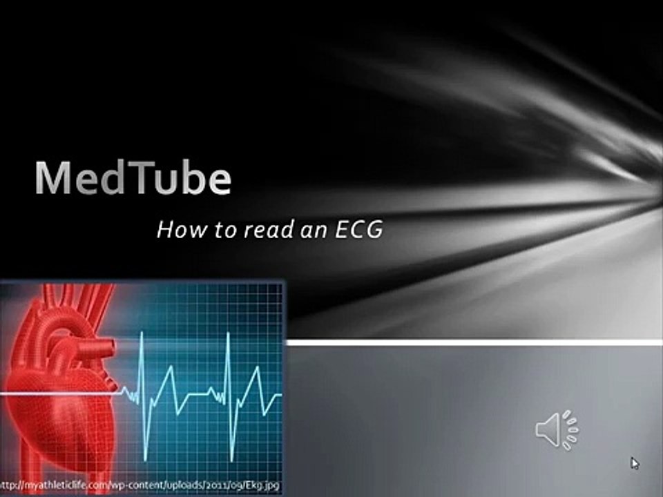 How to read an ECG easily