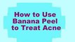 Banana Peel to Treat Acne and Pimple - Banana Benefits for Skin, beauty tips, health tips,