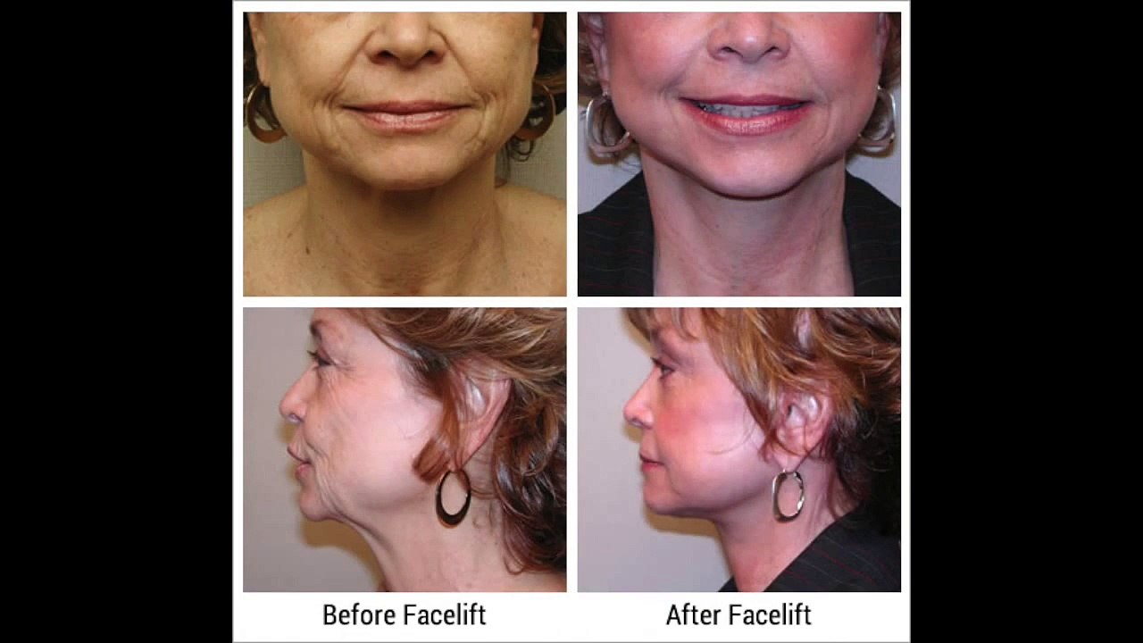 Plastic Surgery | Michigan Cosmetic Surgery