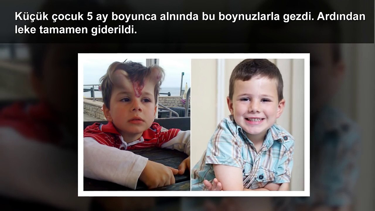 Gerçekleşmiş En İnanılmaz 5 Ameliyat