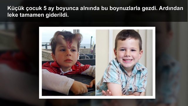 Gerçekleşmiş En İnanılmaz 5 Ameliyat