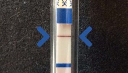 Autotest VIH : comment ça marche ?