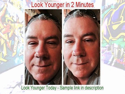 Ronald A. Nelson Reviews (Dermatologist in TN)