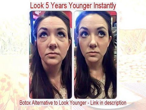 Monica B. Schadlow Reviews (Dermatologist in NY)