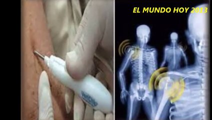 Noticias_ Microchip que se implantara en los seres humanos (verichip) Ultimas noticias