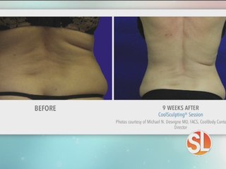 CoolBody Contours makes problem areas disappear