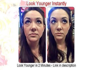 Shelley K. Hoover Reviews (Dermatology in VA)