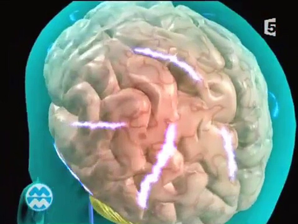 Pourquoi le stress donne mal au ventre