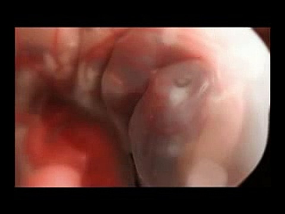 ANIMATION 3D FOETUS