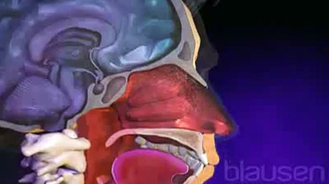 La rhinite allergique