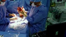 Canal carpien : une nouvelle technique de chirurgie par échographie