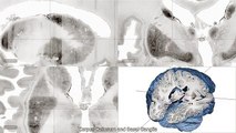 Big Brain : la carte 3D du cerveau humain la plus précise du monde !