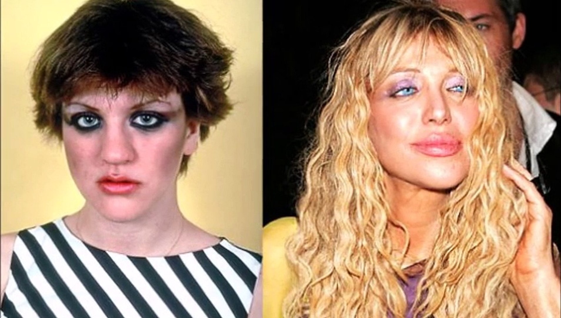 celebrities with bad plastic  surgery