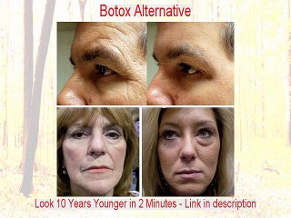 Teri A. Kahn Reviews (Dermatologist in MD)