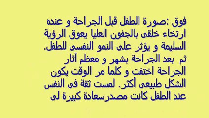 تجميل و شد و اصلاح ارتخاء الجفون و تاتو سحابة القرنية البيضاء د. هيام عادل 2