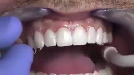 DANT KESE LAGTE HAIN NAYI VIDEO DEKHEN