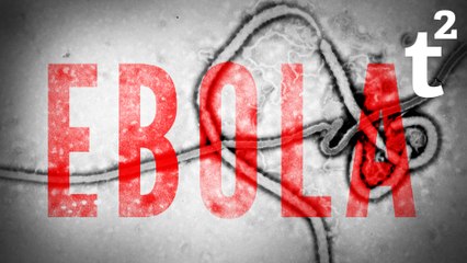 13 Surprising Facts About: Ebola
