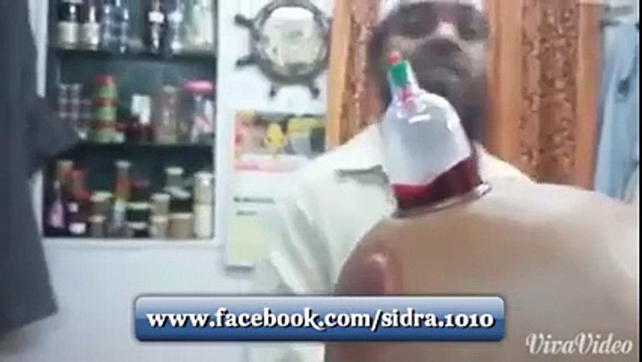 hijama treatment