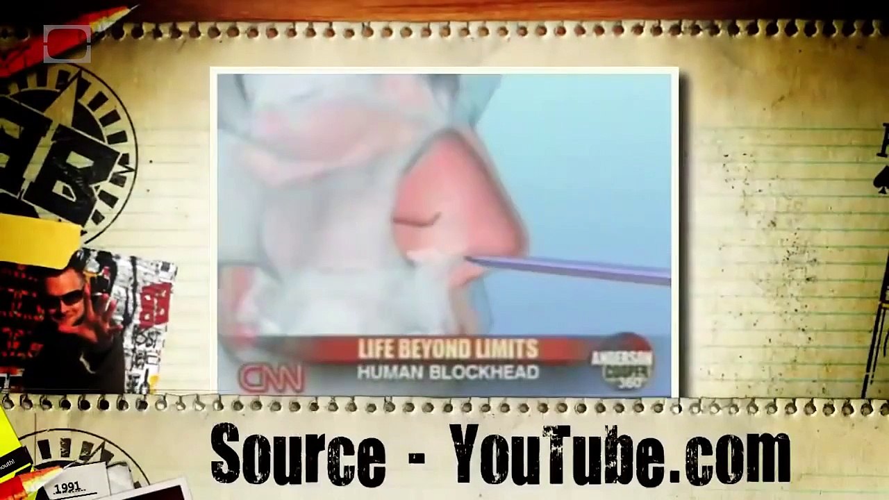 Sticking Nails up Your Nose